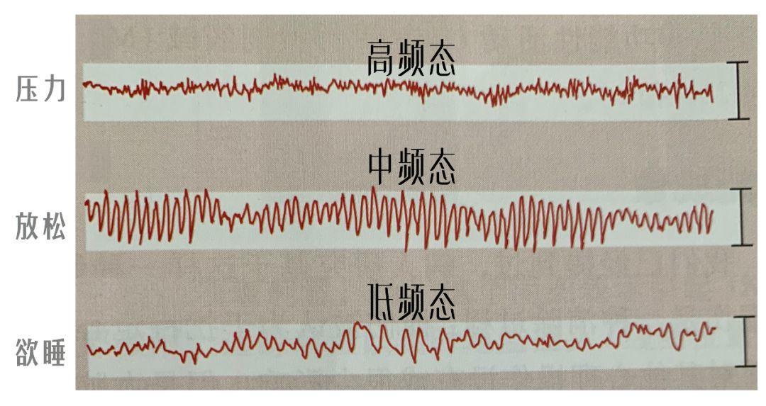 压力简史:被稀释的死亡，但不坏