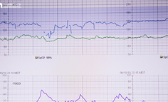 AXURE教程：散点图